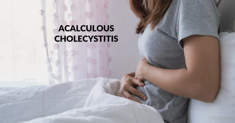 Acalculous Cholecystitis - Causes, Symptoms, and Diagnosis Acalculous Cholecystitis - Causes, Symptoms, and Diagnosis