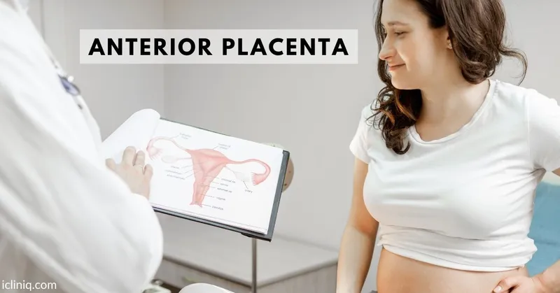 Anterior Placenta - Locations, Diagnosis and Complications Anterior Placenta - Locations, Diagnosis and Complications