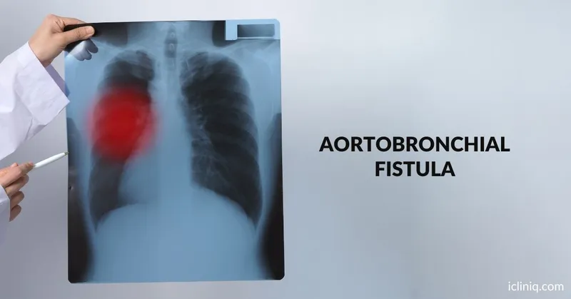 Aortobronchial Fistula - Causes, Symptoms, Diagnosis, and Treatment