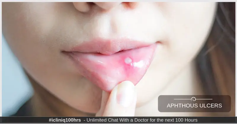 Aphthous Ulcers - Causes, Symptoms, Treatment, and Prevention Aphthous Ulcers - Causes, Symptoms, Treatment, and Prevention
