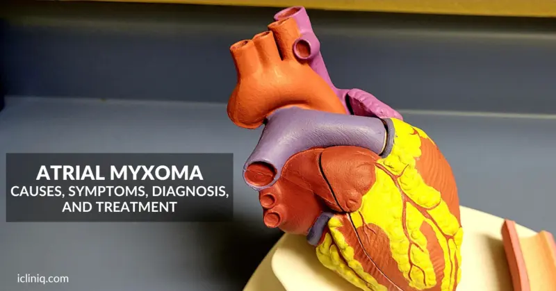 Atrial Myxoma - Causes, Symptoms, Diagnosis, and Treatment