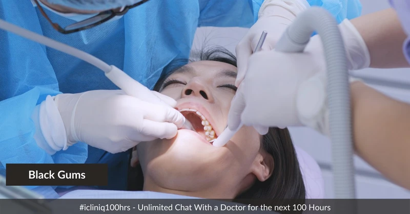 Black Gums and Gingival Depigmentation