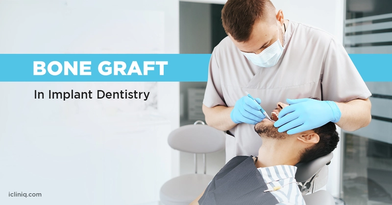 Bone Grafting - Types, Procedure, Risks, and Benefits Bone Grafting - Types, Procedure, Risks, and Benefits