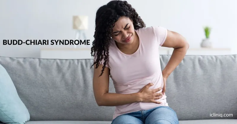 Budd-Chiari Syndrome - Causes, Symptoms and Treatment