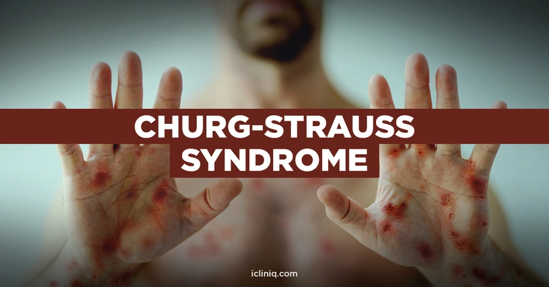 Churg-Strauss Syndrome Churg-Strauss Syndrome