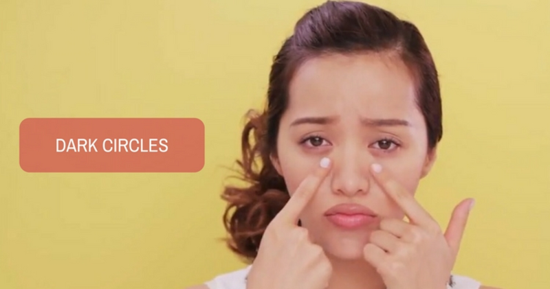 Dark Circles - A Common Cosmetic Concern Dark Circles - A Common Cosmetic Concern