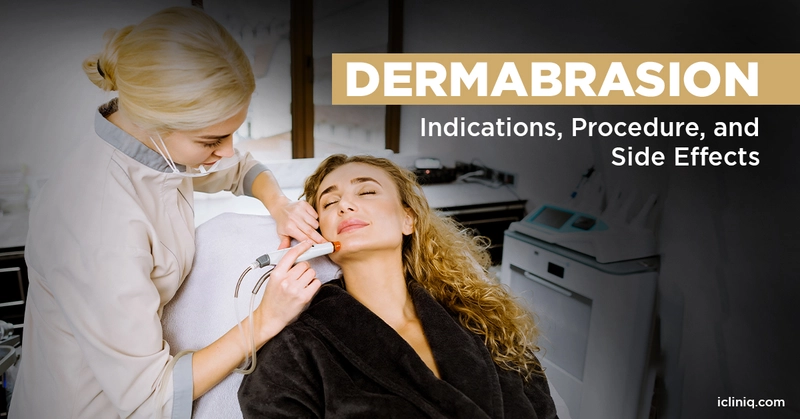 Dermabrasion - Indications, Procedure, and Side Effects