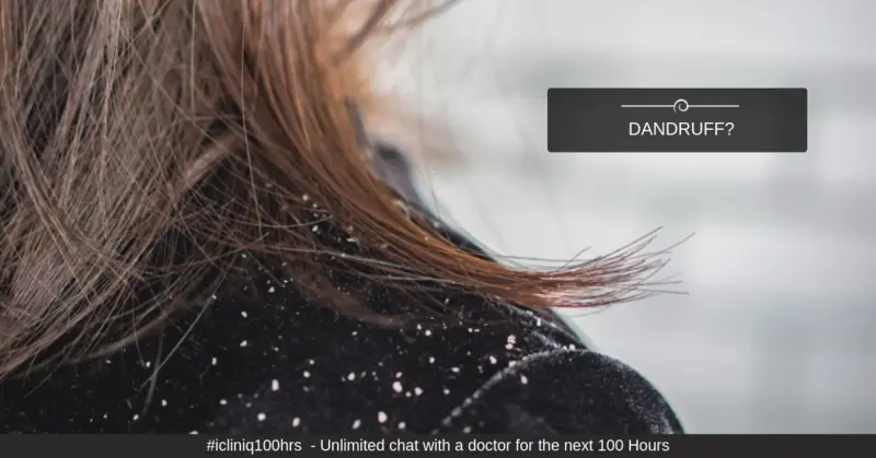 Do You Have Difficulty in Dealing with Dandruff?
