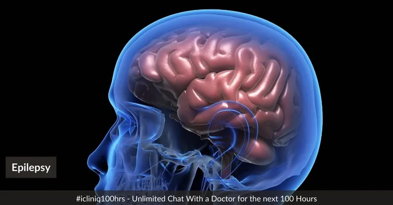 Everything You Should  Know About Epilepsy