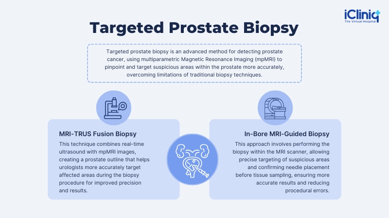 Targeted Prostate Biopsy Targeted Prostate Biopsy