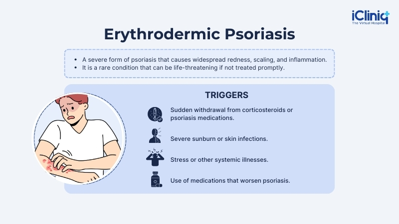 Erythrodermic psoriasis Erythrodermic psoriasis