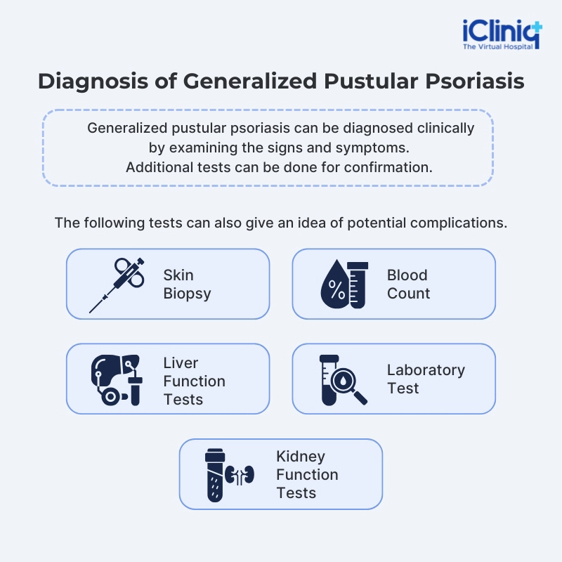 Diagnosis of Generalized pustular psoriasis