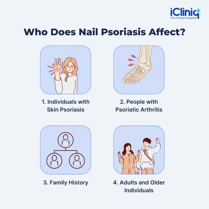 Who Does Nail Psoriasis Affect? Who Does Nail Psoriasis Affect?