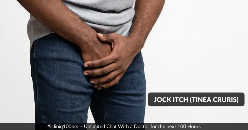 Jock Itch (Tinea Cruris) - Causes, Symptoms, Diagnosis, and Treatment Jock Itch (Tinea Cruris) - Causes, Symptoms, Diagnosis, and Treatment