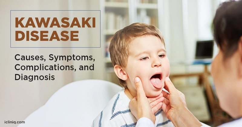 Kawasaki Disease - Causes, Symptoms, Complications, and Diagnosis Kawasaki Disease - Causes, Symptoms, Complications, and Diagnosis