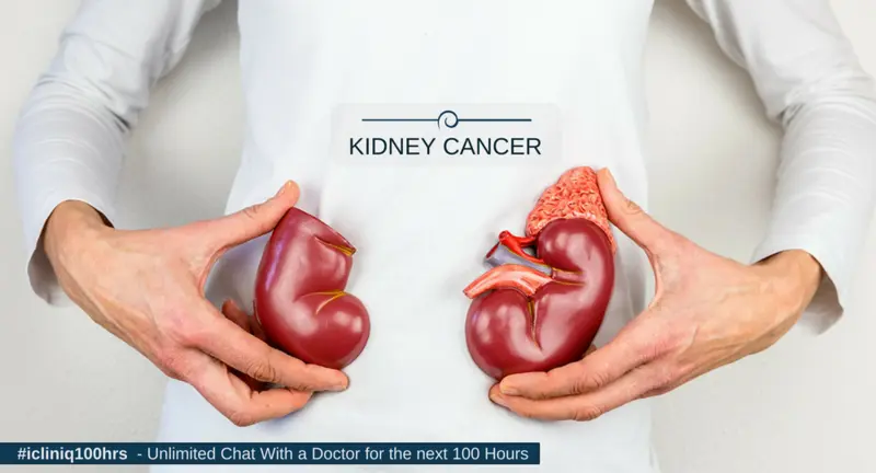 Kidney Cancer: Causes and Treatment Kidney Cancer: Causes and Treatment