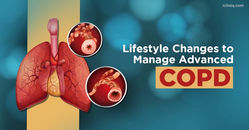 Lifestyle Changes to Manage Advanced COPD Lifestyle Changes to Manage Advanced COPD