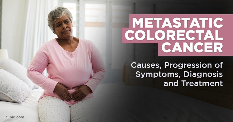 Metastatic Colorectal Cancer- Causes, Risk Factors, Clinical Factors, Diagnosis and Treatment Metastatic Colorectal Cancer- Causes, Risk Factors, Clinical Factors, Diagnosis and Treatment