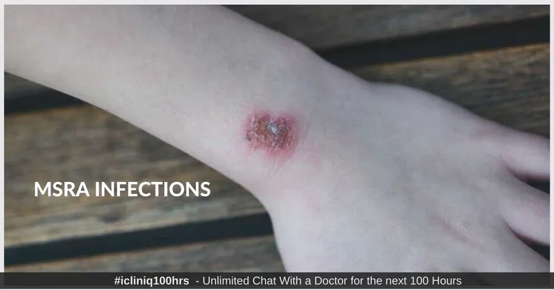 Methicillin-Resistant Staphylococcus Aureus Infection - Symptoms, Causes, Diagnosis, and Treatment Methicillin-Resistant Staphylococcus Aureus Infection - Symptoms, Causes, Diagnosis, and Treatment