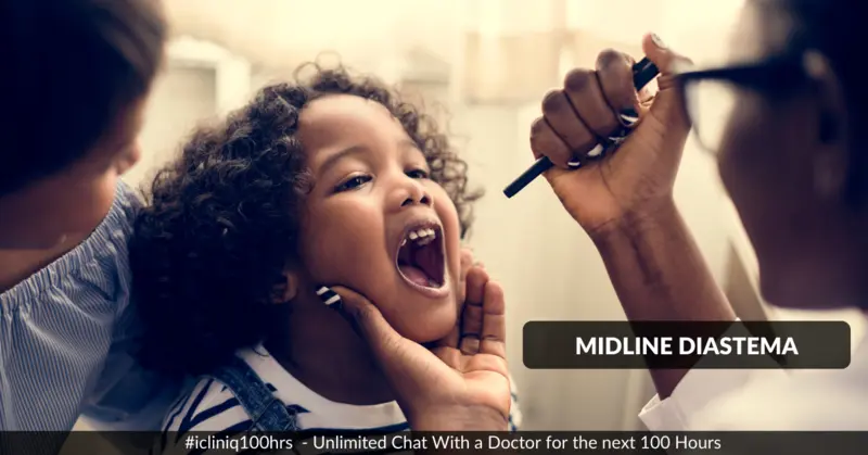 Midline Diastema Midline Diastema