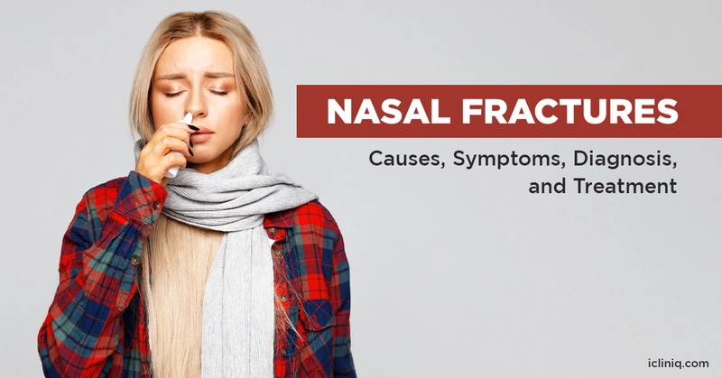 Nasal Fractures - Causes, Symptoms, Diagnosis, and Treatment