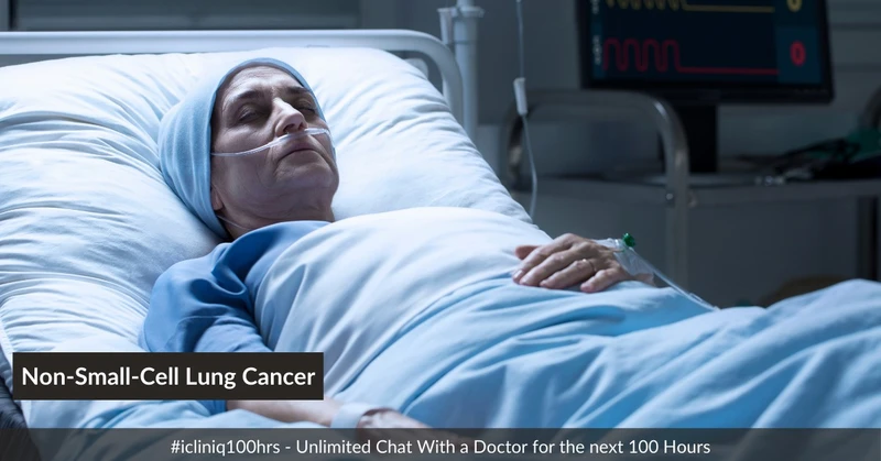 Non-Small Cell Lung Cancer: Symptoms, Stages, Treatment