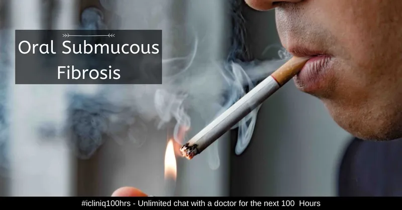 Oral Submucous Fibrosis - Causes, Symptoms, Diagnosis, and Treatment Oral Submucous Fibrosis - Causes, Symptoms, Diagnosis, and Treatment