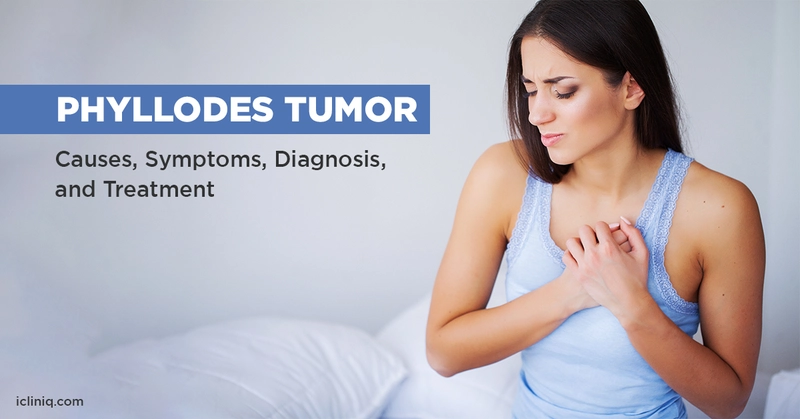 Phyllodes Tumor - Causes, Symptoms, Diagnosis, and Treatment Phyllodes Tumor - Causes, Symptoms, Diagnosis, and Treatment