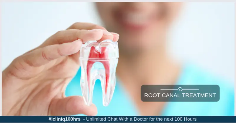 Root Canal Treatment Root Canal Treatment