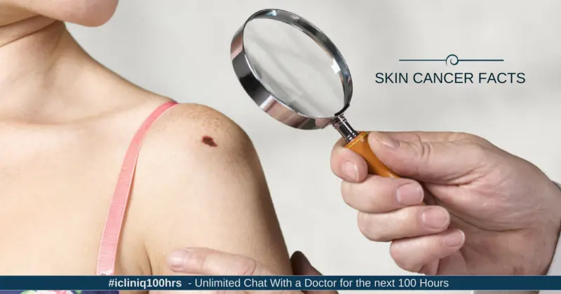 Skin Cancer: Symptoms, Causes, Types, and Treatment Skin Cancer: Symptoms, Causes, Types, and Treatment