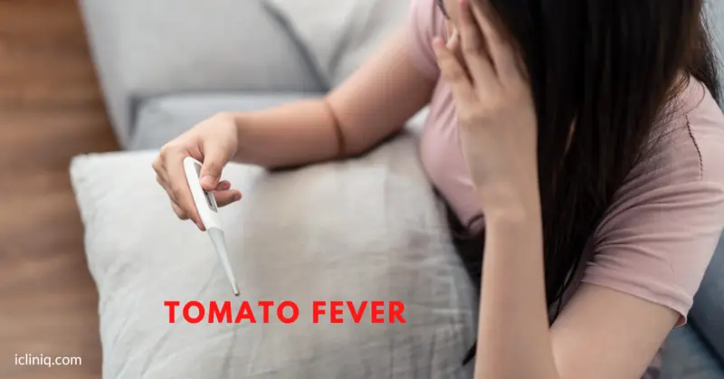 Tomato Fever - Causes, Symptoms, Diagnosis, Treatment, and Prevention
