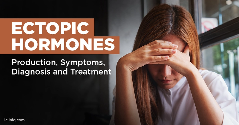 What Are Ectopic Hormones 