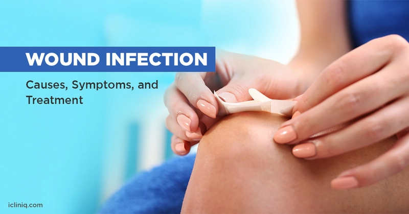 Wound Infection - Causes, Symptoms, and Treatment Wound Infection - Causes, Symptoms, and Treatment