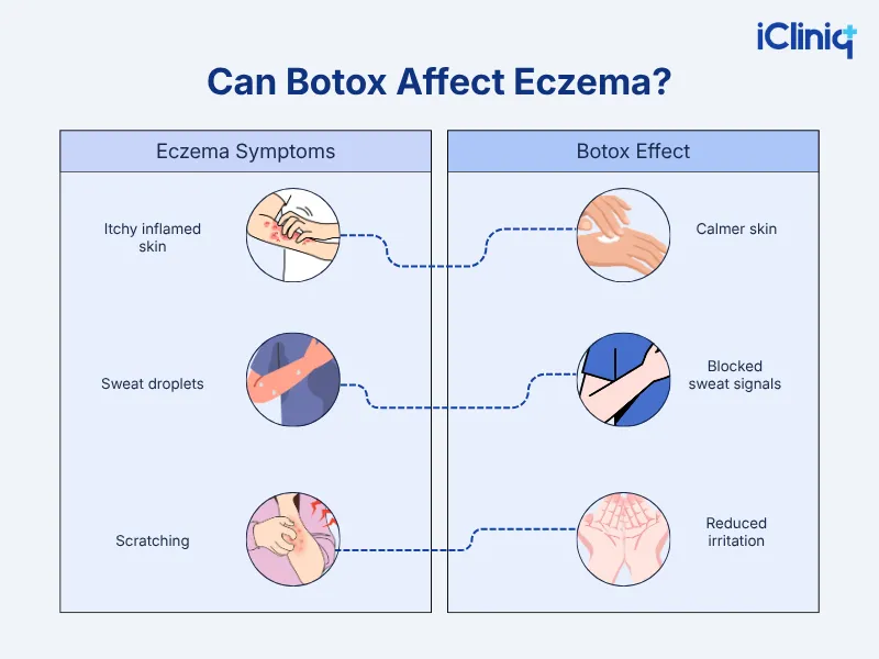 Botox Actually Treat Eczema