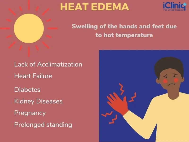 Risk factors of heat edema
