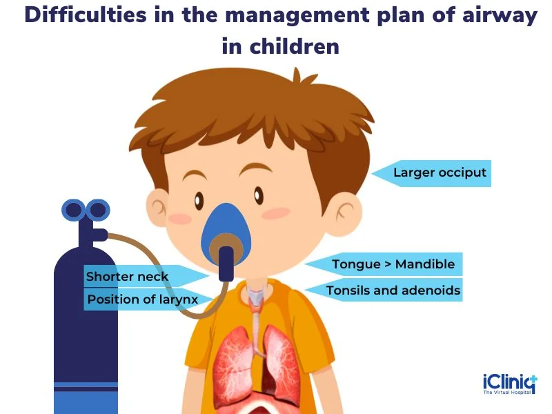 management plan of airway in children