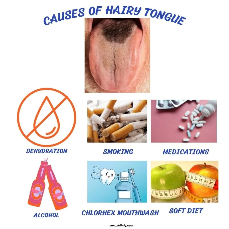 how was tobacco used in the past Tobacco how was tobacco used in the past Tobacco