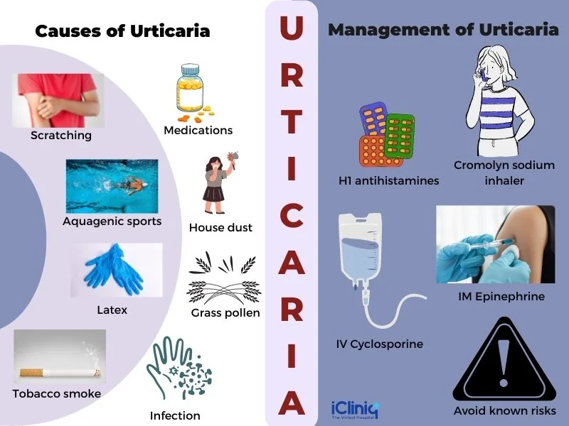 Urticaria Urticaria