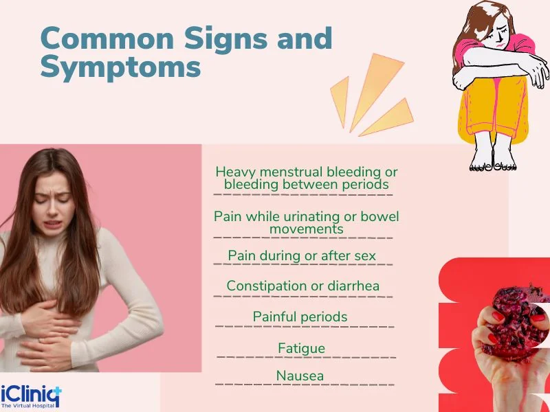 endometriosis- signs and symptoms