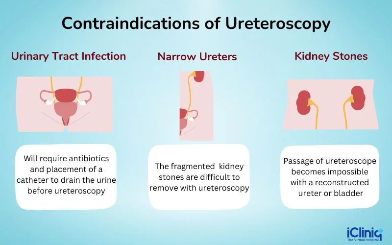 Contraindications of ureteroscopy Contraindications of ureteroscopy