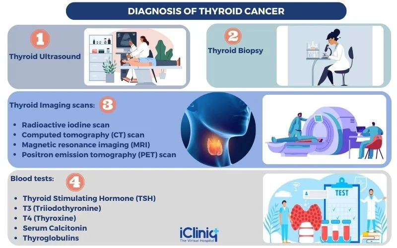Diagnosis of thyroid cancer
