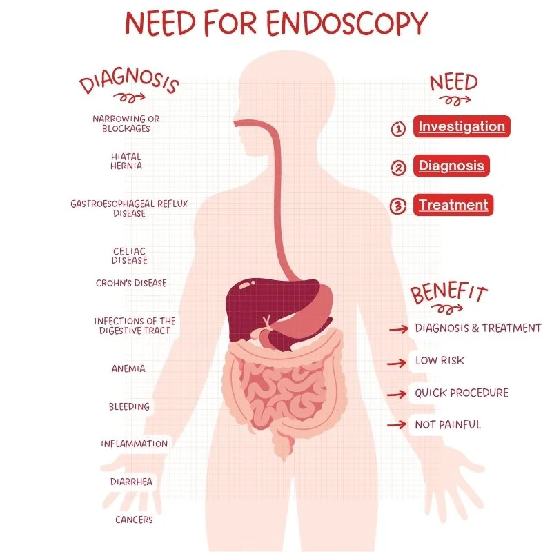 Need for endoscopy