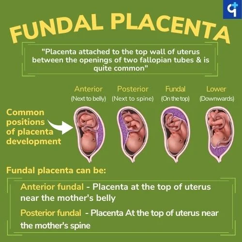 FP