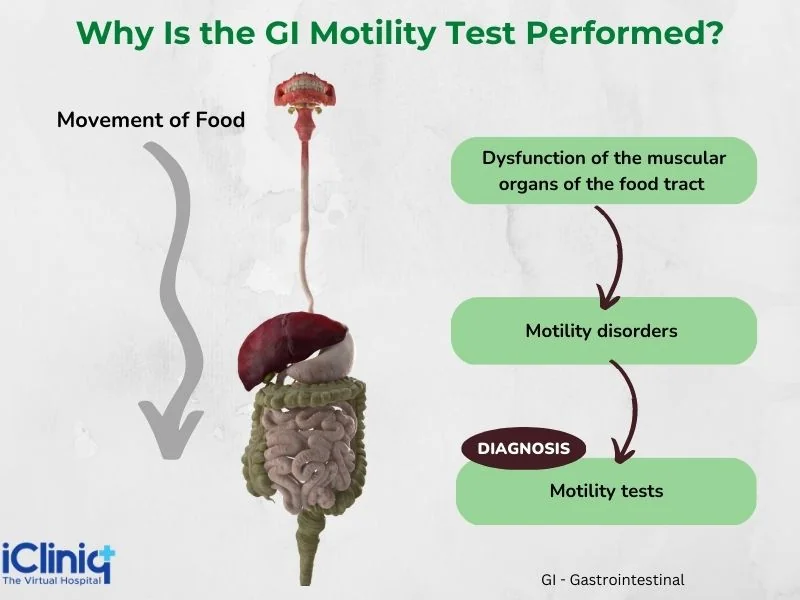 Why is the GI motility test performed? Why is the GI motility test performed?