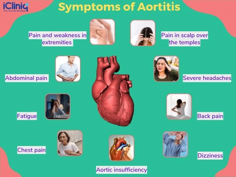 Symptoms of aortitis