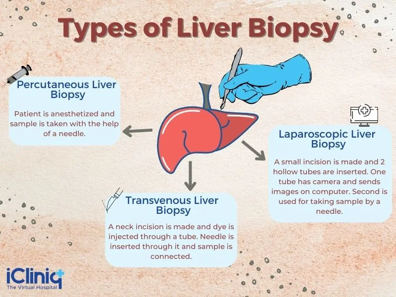 Types of liver biopsy