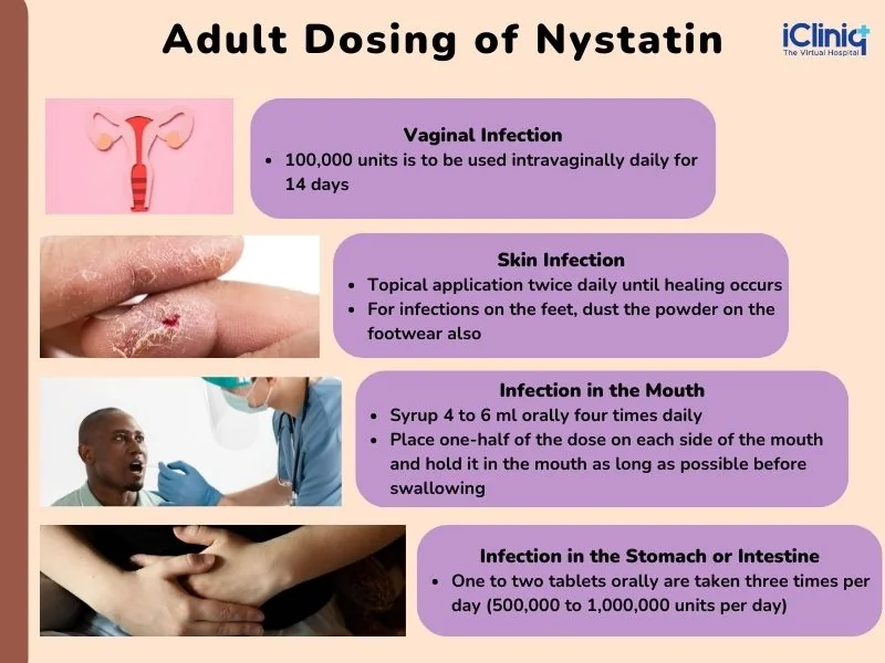 Nys