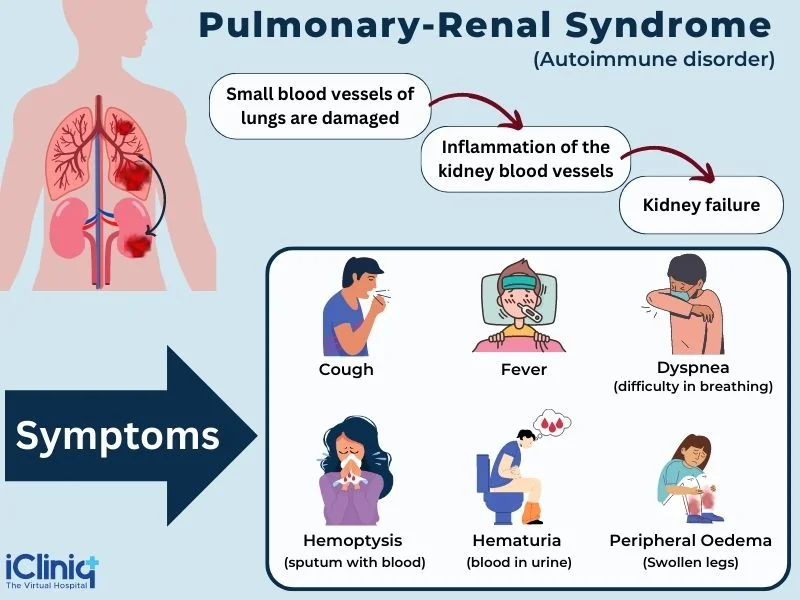 Symptoms of pulmonary-renal syndrome Symptoms of pulmonary-renal syndrome