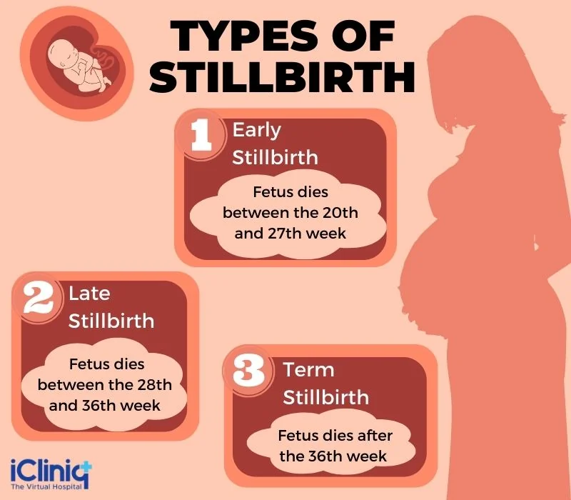 types of still birth types of still birth