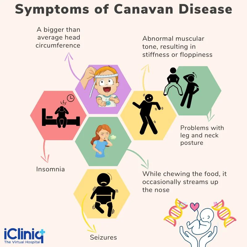 Symptoms of Canavan Disease